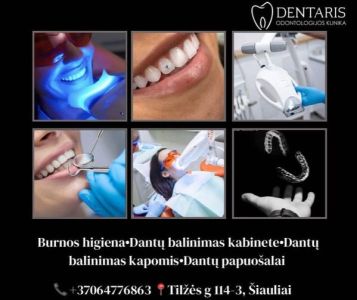 Dantų balinimas