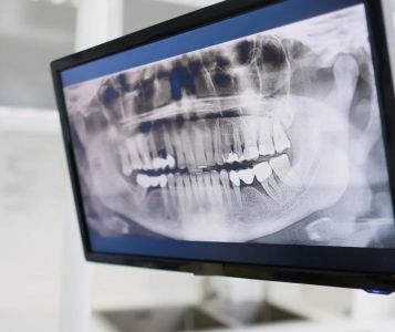 Aukštos raiškos panoraminės dantų nuotraukos (OPG) ir 3D kompiuterinės tomografijos (CBCT) tyrimai.