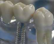 PERLADENTA, UAB - visos odontologo paslaugos Raseiniuose, Ariogaloje