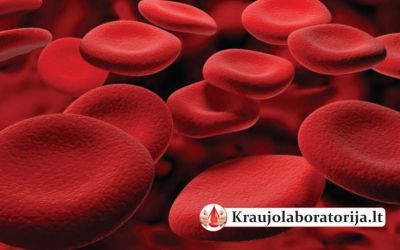 INVITRO DIAGNOSTIKA, UAB