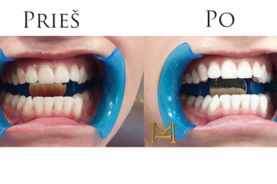 MIESTO KLINIKA, UAB - visos odontologų paslaugos  Akmenė, Kuršėnai, Šiaulių apskritis