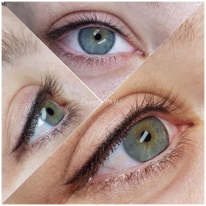 MediAnna ESTETIKOS KLINIKA, UAB Šiauliuose