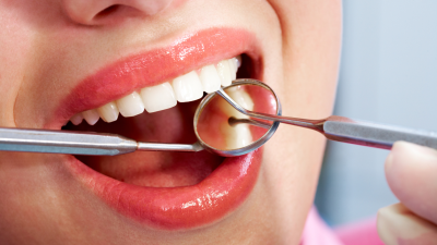 DNR Clinic, MB - odontologijos klinika Vilniuje, terapinis dantų gydymas, estetinis plombavimas, dantų protezavimas, burnos higiena, dantų implantacija Viršuliškėse, Šeškinėje