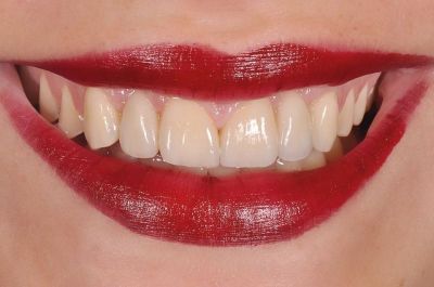 ODONTOLOGIJA JUMS, UAB - visos odontologų paslaugos Kaune